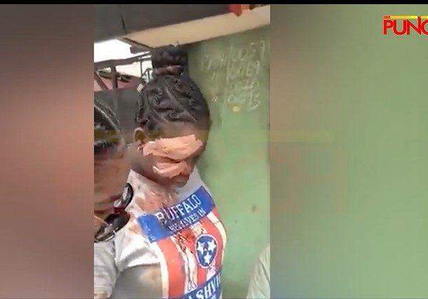 25380 i felt fulfilled going back to vote after being attacked by thugs lagos woman 25380 i felt fulfilled going back to vote after being attacked by thugs lagos woman