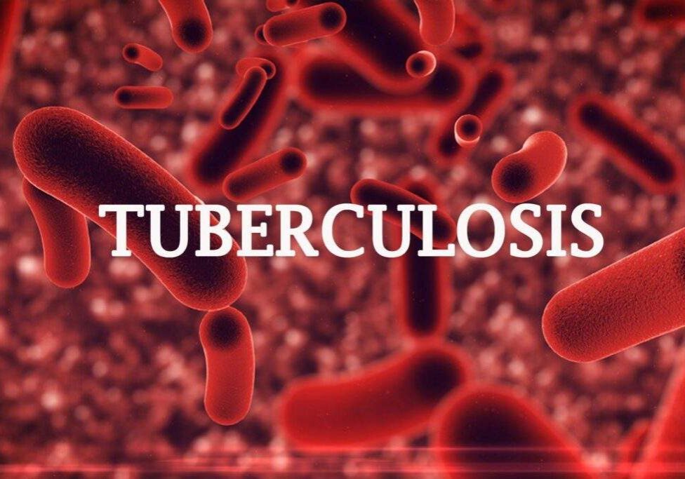 33559 nigeria to eradicate tuberculosis by 2030