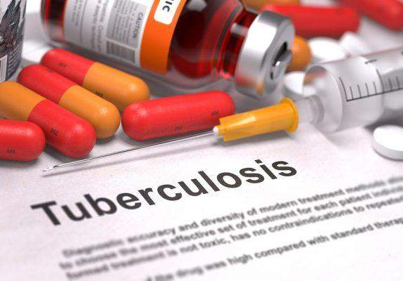 34270 nigerias tb case finding rises by 50 says who