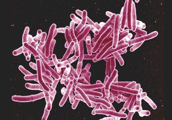 34325 experts differ on fgs commitment to ending tuberculosis