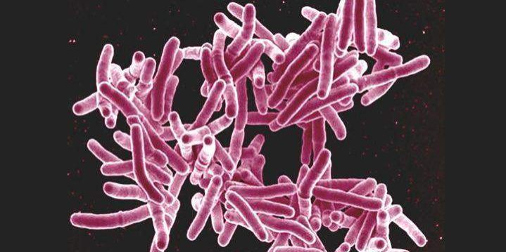 34325 experts differ on fgs commitment to ending tuberculosis 34325 experts differ on fgs commitment to ending tuberculosis