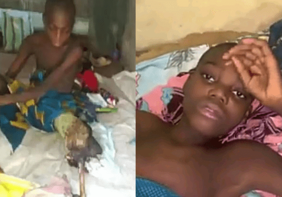 39227 17 year old to undergo leg amputation family seeks help 39227 17 year old to undergo leg amputation family seeks help