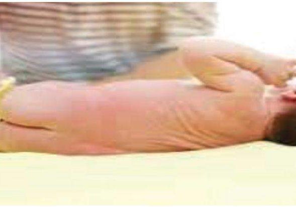 4063 babies stool may cause diarrhoea hepatitis paediatrician warns 4063 babies stool may cause diarrhoea hepatitis paediatrician warns