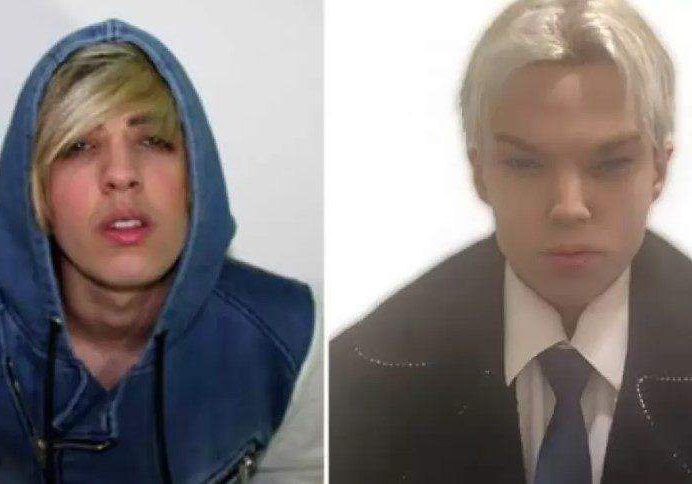 51842 canadian actor dies after 12 surgeries to look k pop singer 51842 canadian actor dies after 12 surgeries to look k pop singer