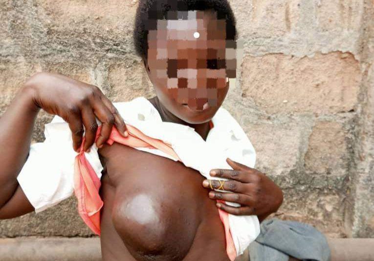 52751 mother of two to undergo breast cancer surgery husband seeks help