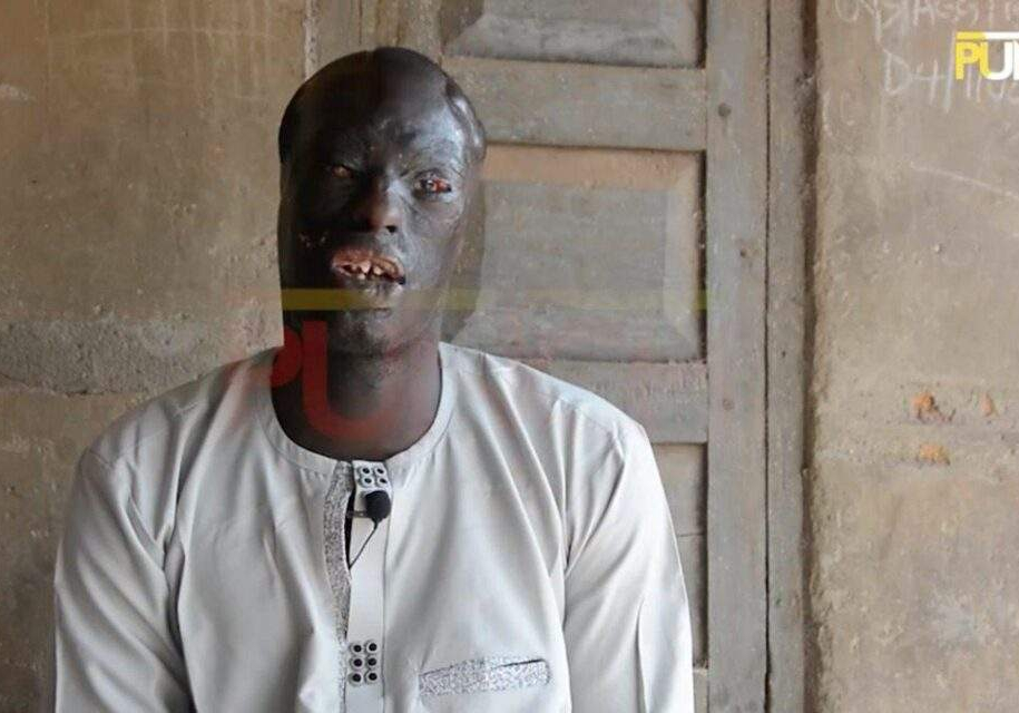 5987 how my cousin bathed fed me with acid as a baby