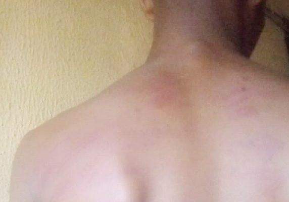 67914 mother takes action after lagos principal brutalizes 14 year old pupil 67914 mother takes action after lagos principal brutalizes 14 year old pupil