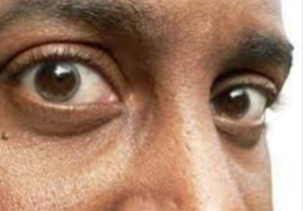 82333 igbo yoruba elderly men at higher risks of glaucoma induced blindness expert warns 82333 igbo yoruba elderly men at higher risks of glaucoma induced blindness expert warns
