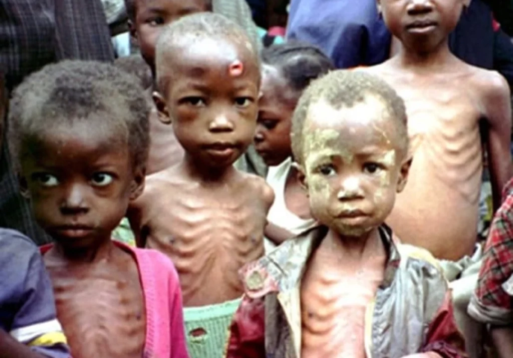 CS SUNN Raises Alarm on Malnutrition Crisis in Nigeria Calls for