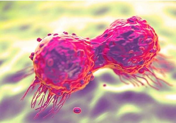 Cancer killed over 500000 Africans in 2022 — WHO Cancer killed over 500000 Africans in 2022 — WHO