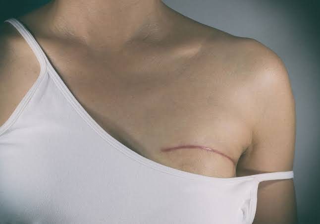 Distraught Father Pleads with Surgeon to Halt Transgender Surgery on