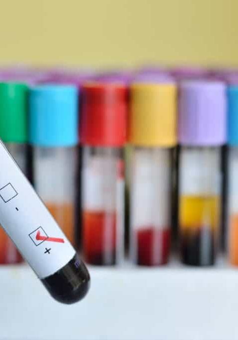 Girls' Rights Under Threat: 75% of HIV Infections in Adolescents