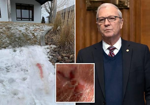 He went through a lot - Trump confirms Senator Kevin Cramer's head injury