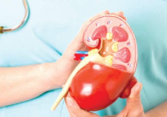 Kidney Failure Prevention: 10 Lifestyles to Avoid and 5 Healthy Kidney Failure Prevention: 10 Lifestyles to Avoid and 5 Healthy