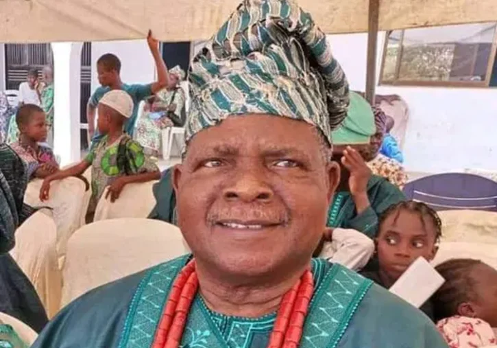 Veteran actor, Kola Oyewo speaks on battle with prostate enlargement