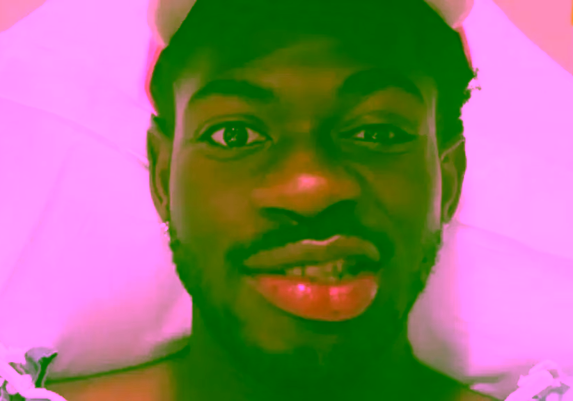 Lil Nas X reveals one side of his face is paralyzed