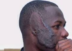 Man cuts off friends ear in Lagos — Daily Nigerian Man cuts off friends ear in Lagos — Daily Nigerian