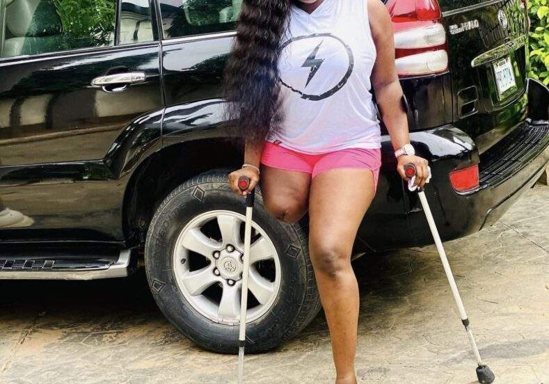 Men date me out of pity – Amputee actress Doris Men date me out of pity – Amputee actress Doris