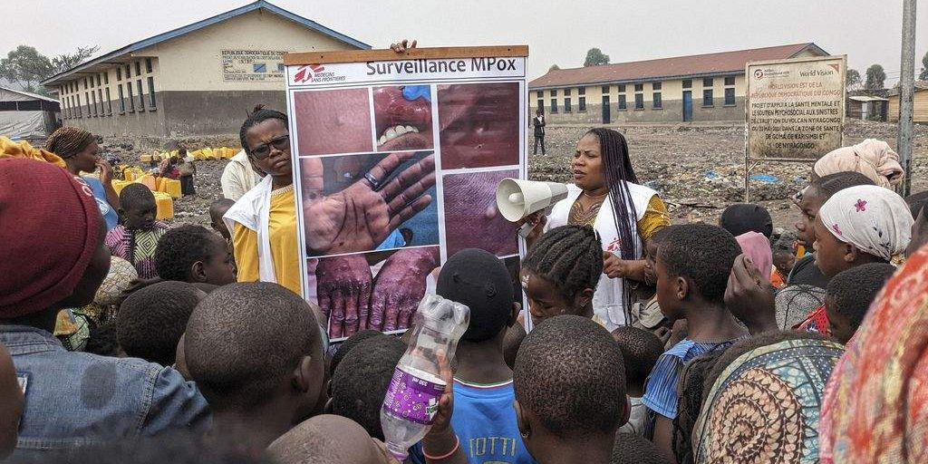 Monkeypox Outbreak Spreads in Congo with Rising Cases and Higher Monkeypox Outbreak Spreads in Congo with Rising Cases and Higher