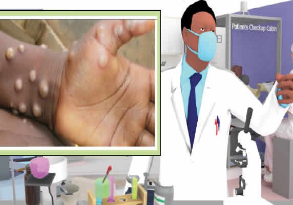 Mpox Spreads to 25 States in Nigeria Mpox Spreads to 25 States in Nigeria