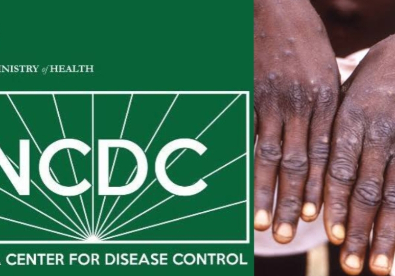 NCDC raises alarm over multiple disease outbreaks, calls for urgent measures — Daily Nigerian