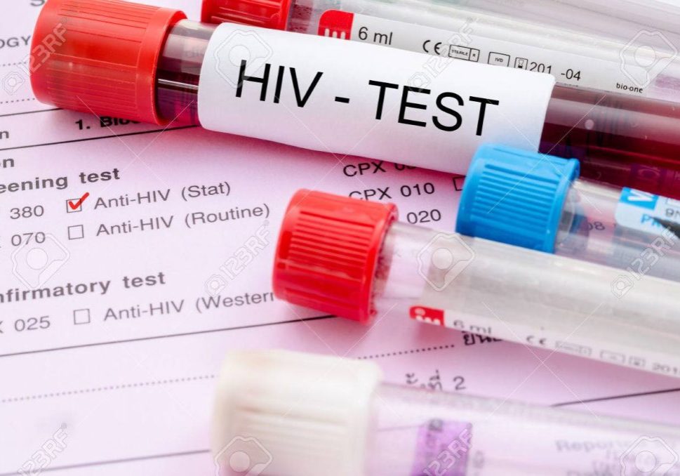 Experts welcome new HIV injection breakthrough, decry high cost — Daily Nigerian