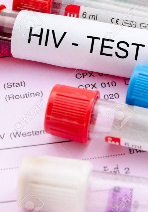 Experts welcome new HIV injection breakthrough, decry high cost — Daily Nigerian