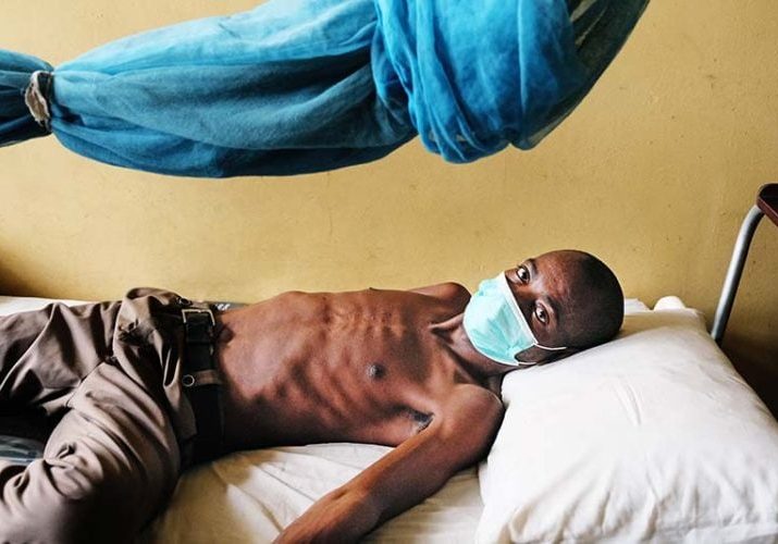 8,629 Tuberculosis cases treated out of 14,908 cases identified in Niger