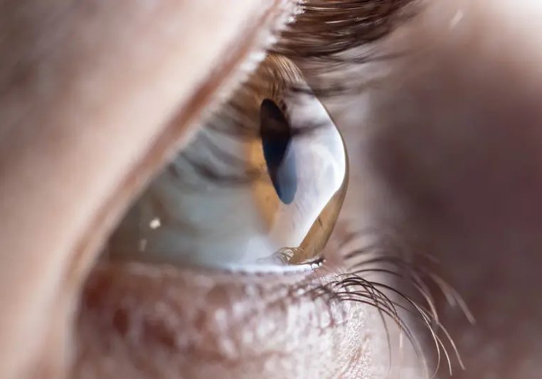 24 Million Nigerians suffer from sight lost - DUFUTHS VC, Uneke