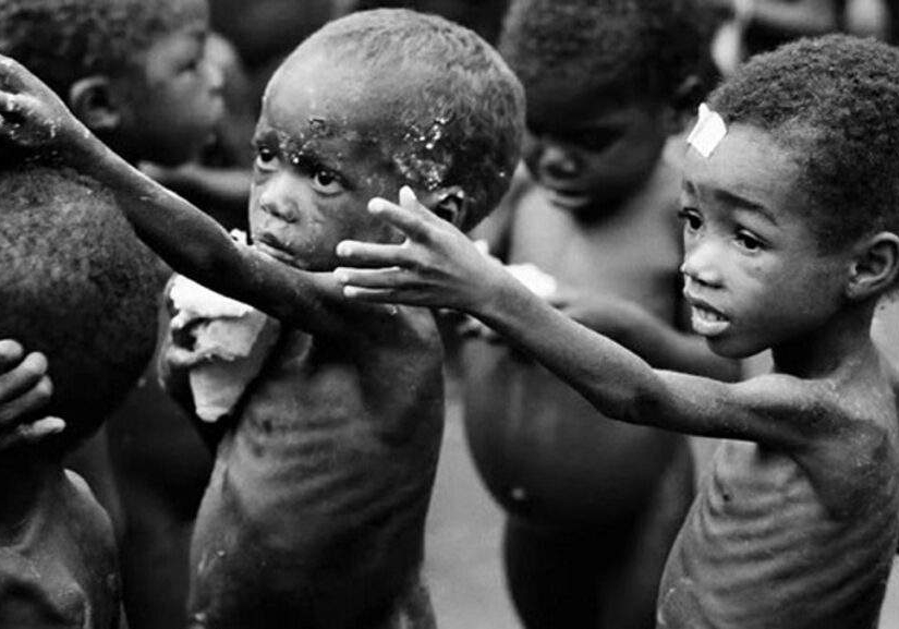 One in Four Nigerian Children Under Five Malnourished