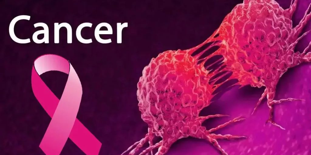 Pro Inflammatory Diets Linked to Oral Cancer Development Sugary drinks, refined carbohydrates, processed meats, major causes of cancer - Varsity Don