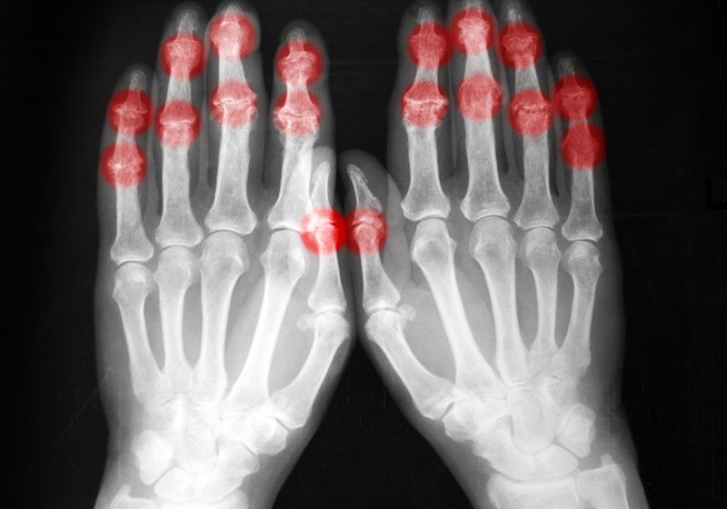 Radiography expert warns of manpower crisis as demand surges