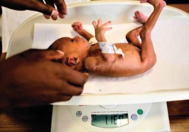 Stakeholders advocate rice fortification to combat anaemia
