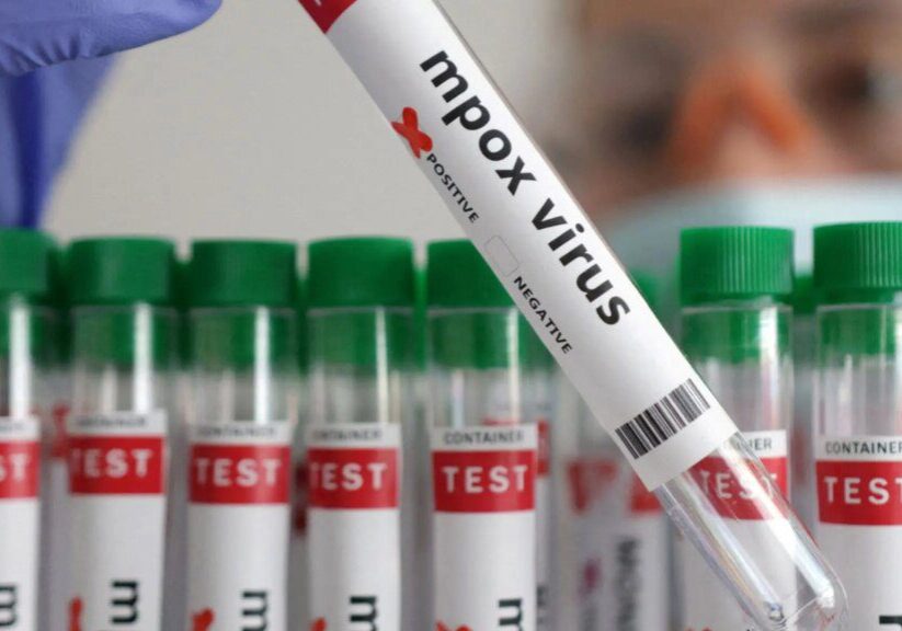 UK Detects First Case of mpox, Formerly Known as Monkeypox UK Detects First Case of mpox, Formerly Known as Monkeypox