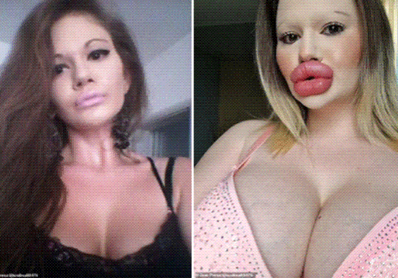 largest lip largest lip