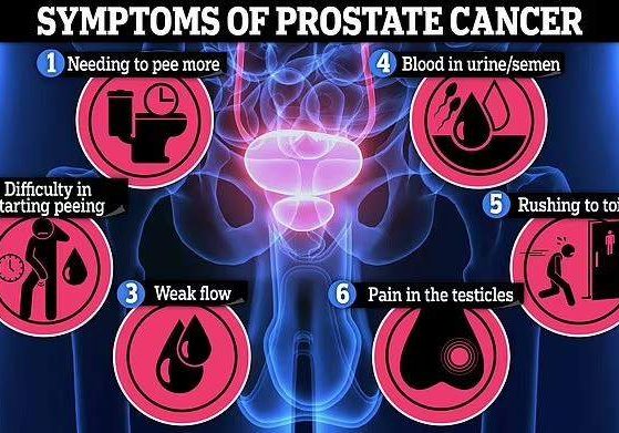prostate prostate