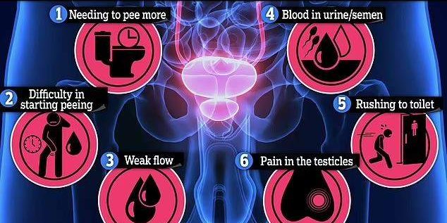prostate prostate