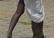 44080 ondo residents receive free elephantiasis surgery