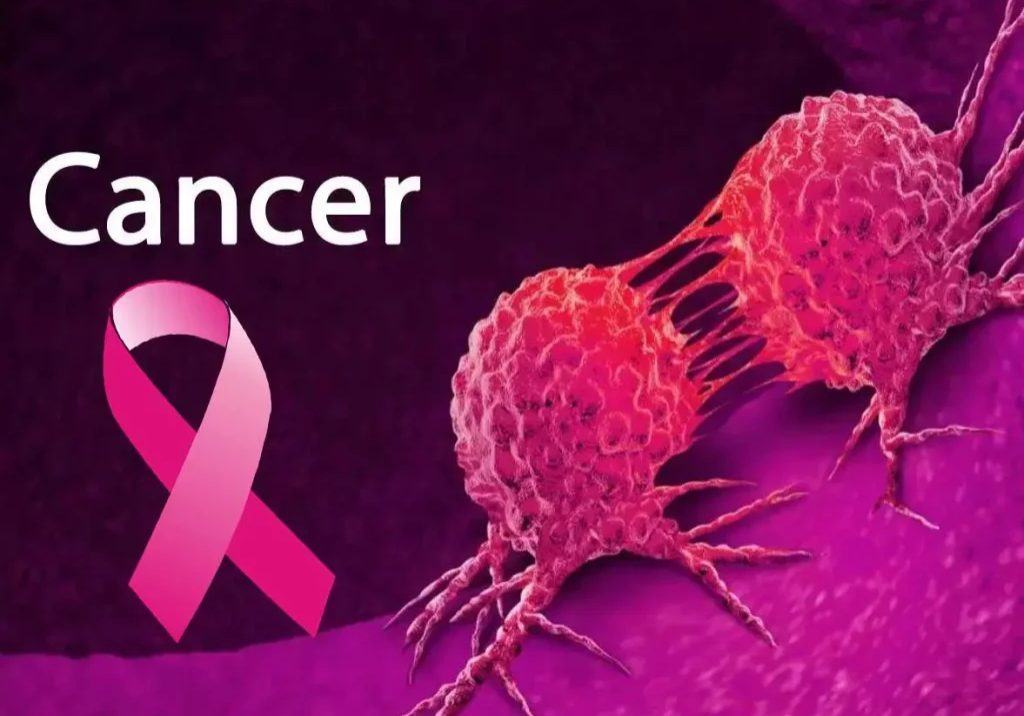 Cancer: Expert warns against random eating, drinking